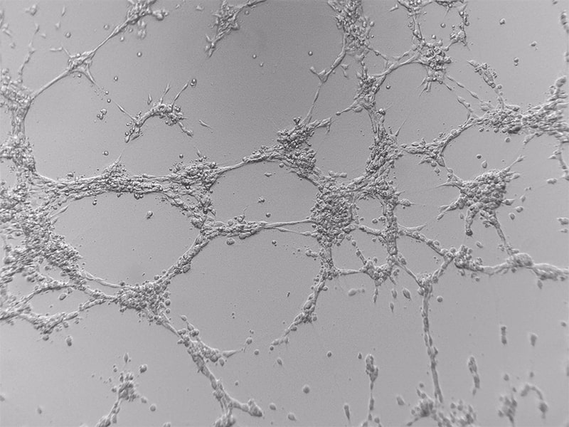 In vitro tube formation assay, Aortic ring assay-min