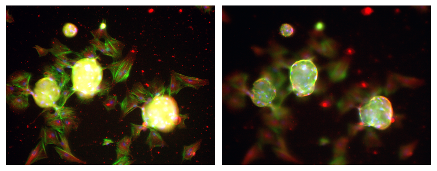 Staining of porcine mesenchymal stem cells (pMSCs) growing on LifeGel (α-Tubulin - red, F-actin- green, nuclei - blue).